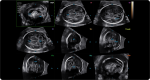 5D CNS